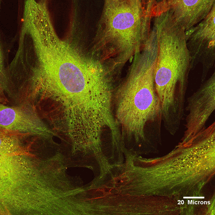 Image: Human mesenchymal stem cells (Photo courtesy of the Ottawa Hospital Research Institute).